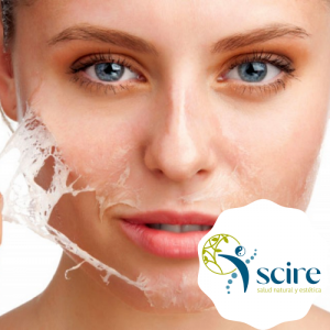 Peeling controlado