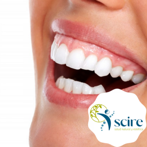 Corrección de sonrisa gingival