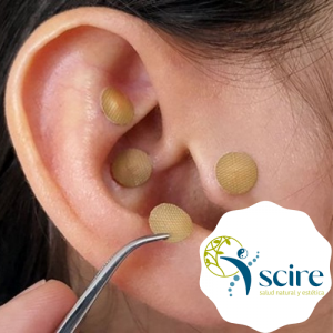 Auriculoterapia