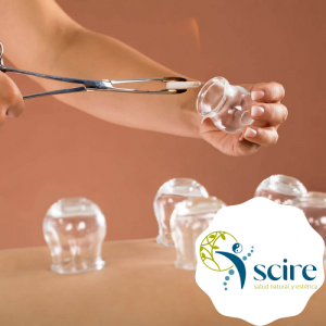 Ventosas o cupping