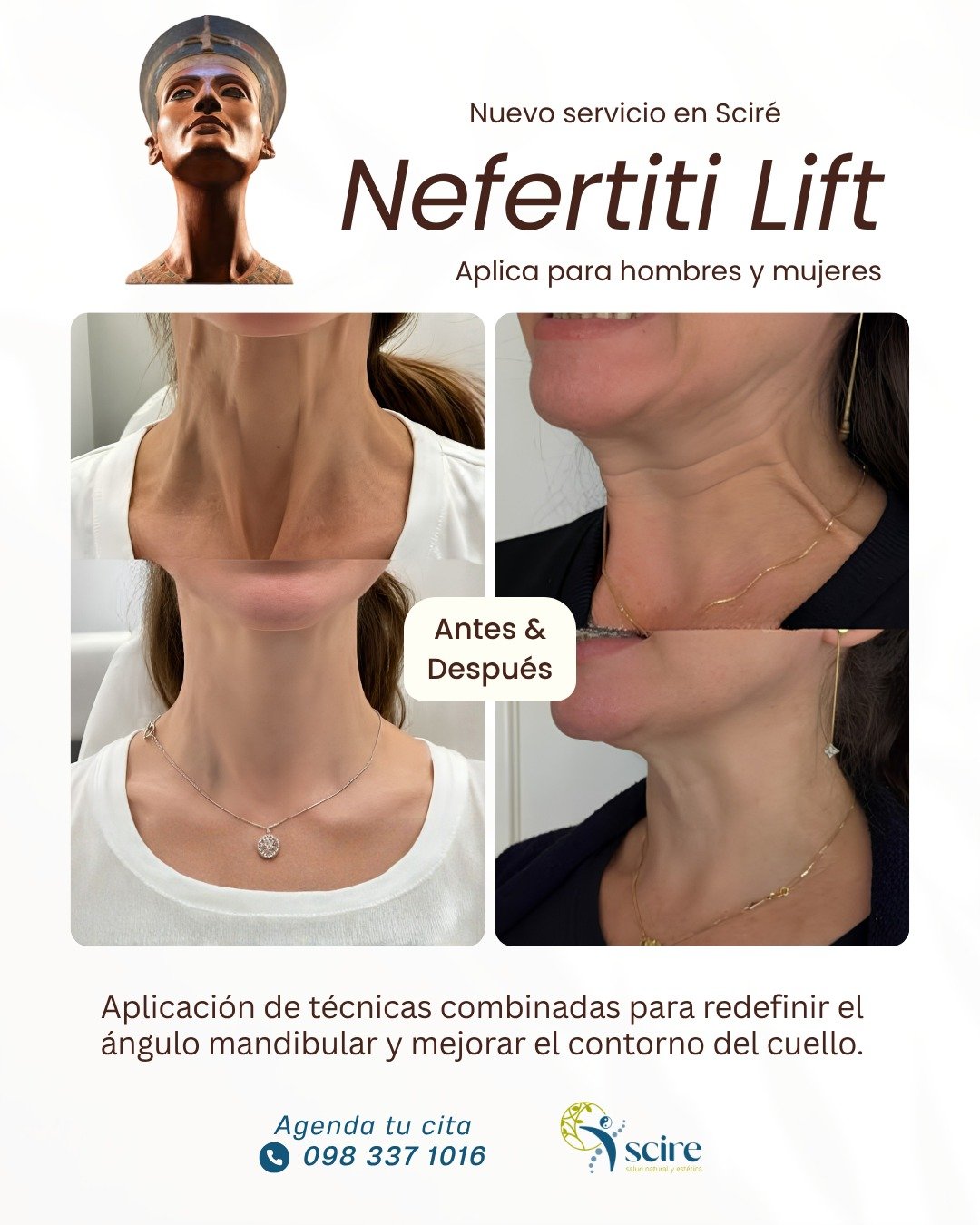 Nefertiti Lift